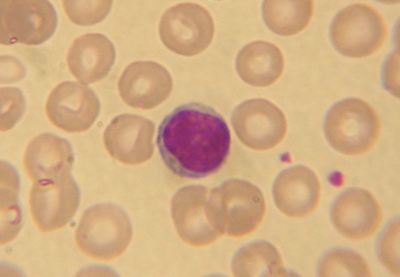 Soubor:Lymphocyte2.jpg