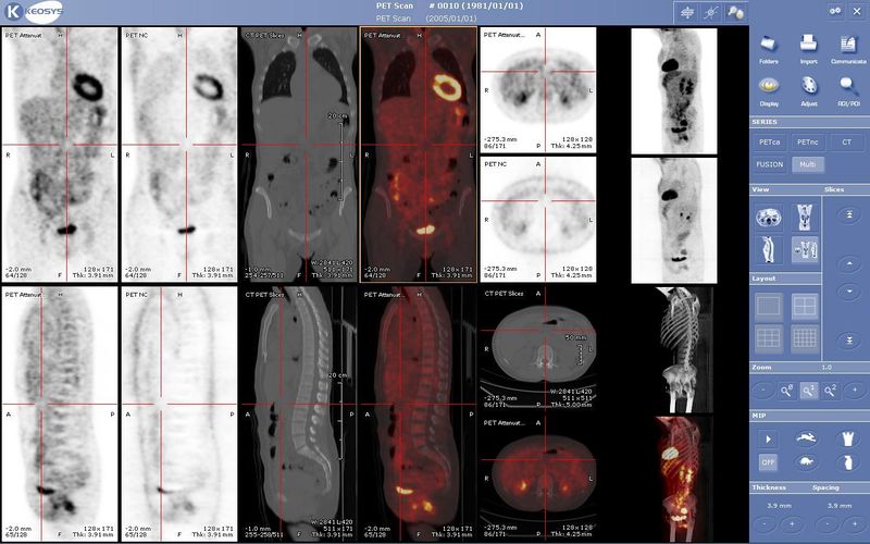 Soubor:Viewer medecine nucleaire keosys.JPG