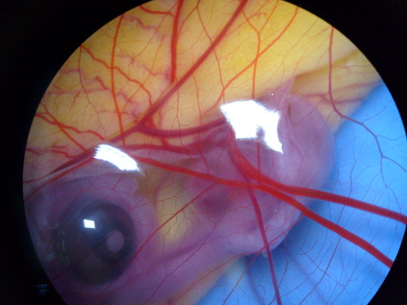 Soubor:Chicken-embryo-1week old-stereomicroscope.jpg