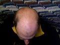 Bald head.jpg