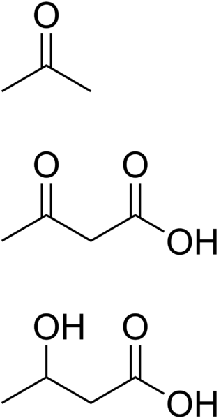 Soubor:Ketone bodies.png