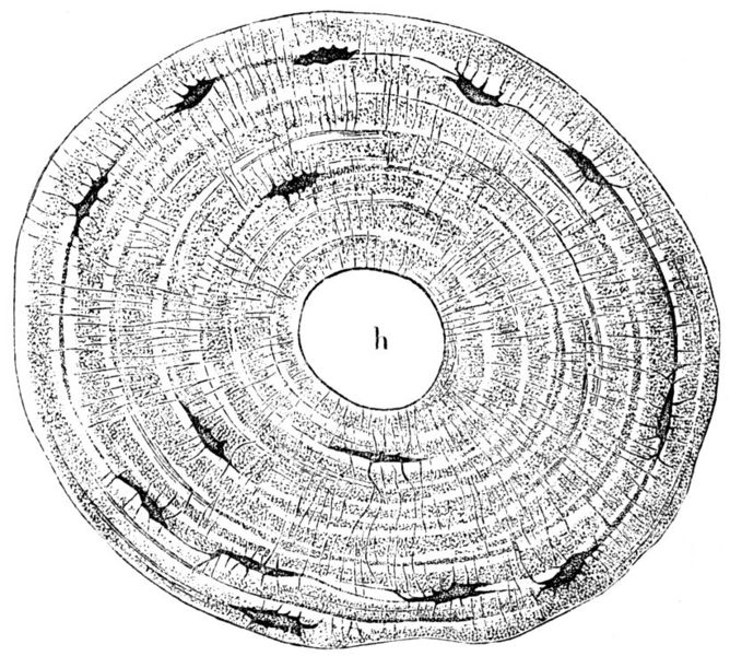 Soubor:Knochenschnitt-drawing.jpg