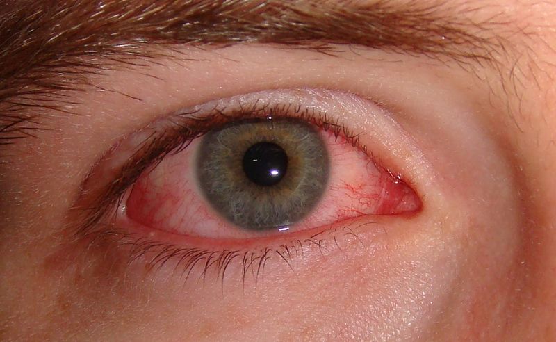 Soubor:Pink eye.jpg